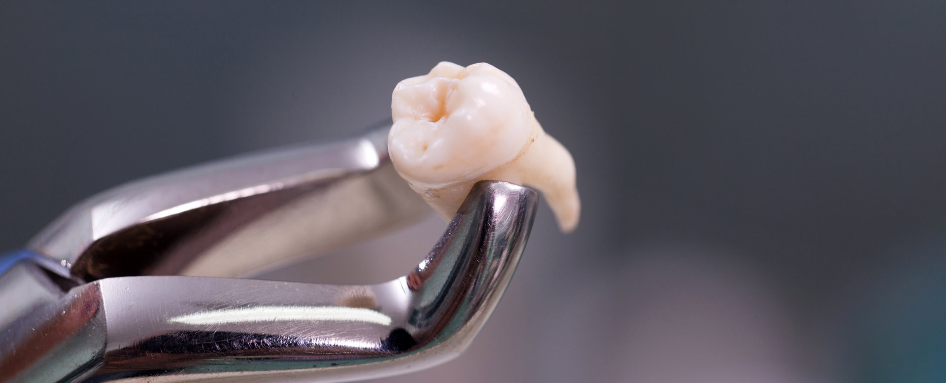 dental-and-oral-surgeries