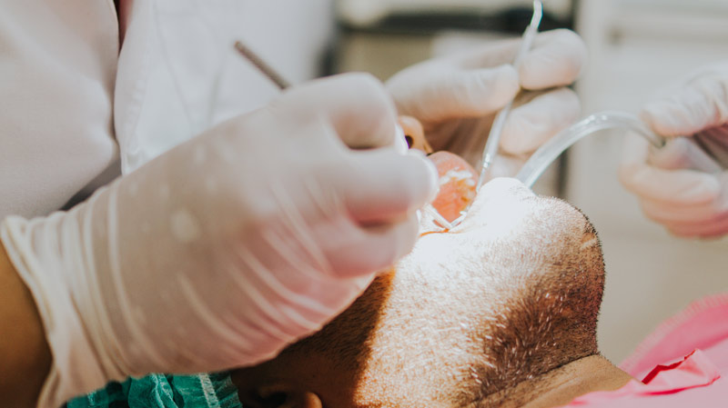 Teeth Cleaning